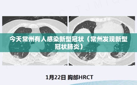 今天常州有人感染新型冠状（常州发现新型冠状肺炎）