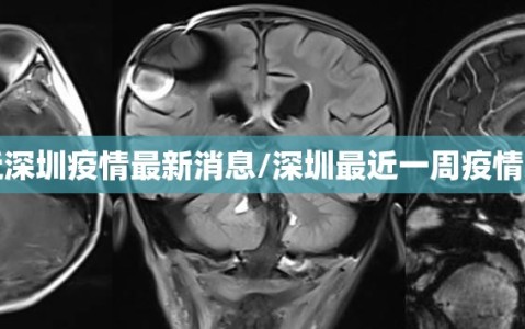 最近深圳疫情最新消息/深圳最近一周疫情数据